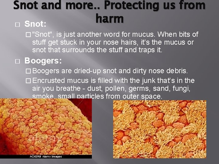 Snot and more. . Protecting us from harm � Snot: � "Snot", is just Snot and more. . Protecting us from harm � Snot: � "Snot", is just