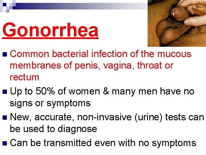 Gonorrhea n Common bacterial infection of the mucous membranes of penis, vagina, throat or