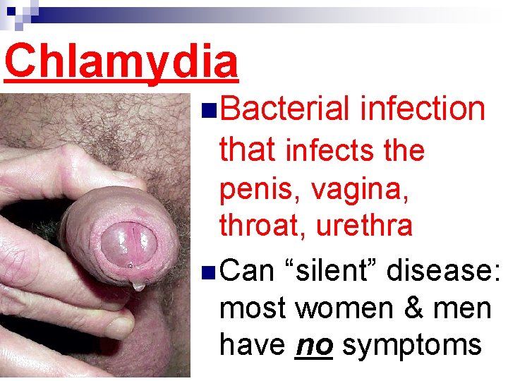 Chlamydia n. Bacterial infection that infects the penis, vagina, throat, urethra n Can “silent”