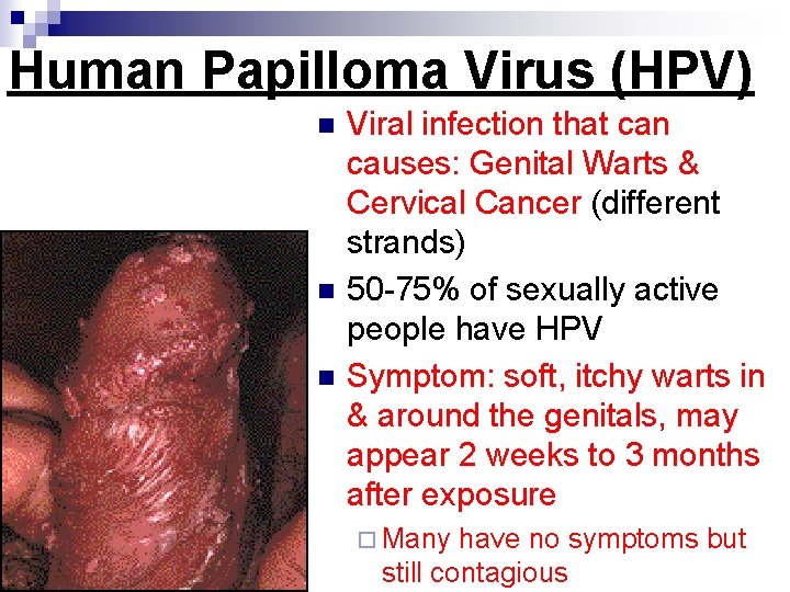 Human Papilloma Virus (HPV) n n n Viral infection that can causes: Genital Warts