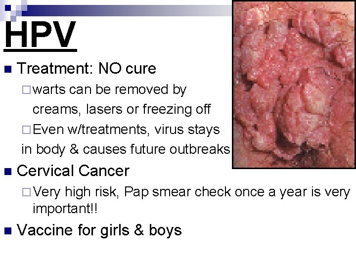 HPV n Treatment: NO cure ¨ warts can be removed by creams, lasers or