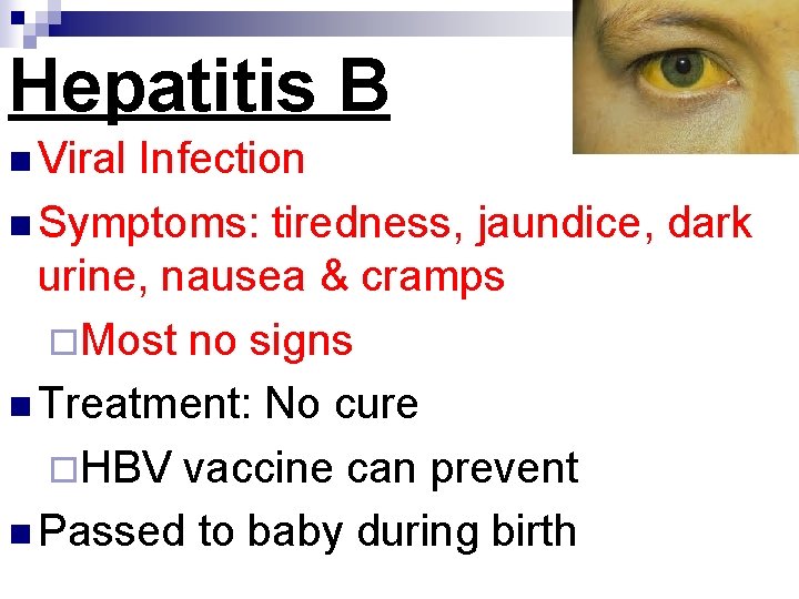 Hepatitis B n Viral Infection n Symptoms: tiredness, jaundice, dark urine, nausea & cramps