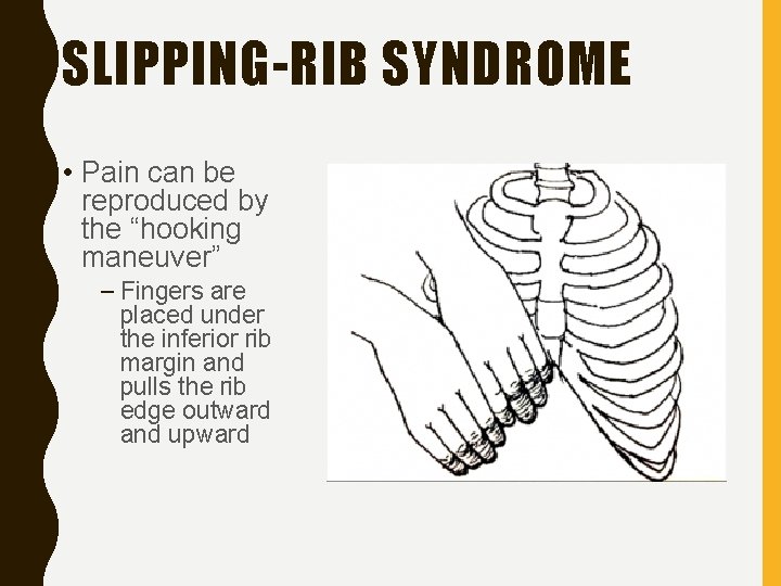 SLIPPING-RIB SYNDROME • Pain can be reproduced by the “hooking maneuver” – Fingers are