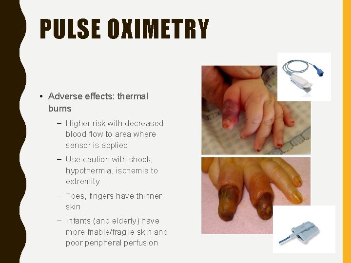 PULSE OXIMETRY • Adverse effects: thermal burns – Higher risk with decreased blood flow