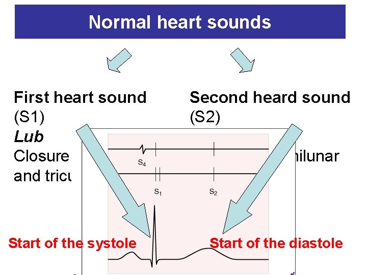 Normal heart sounds First heart sound (S 1) Lub Closure of the mitral and
