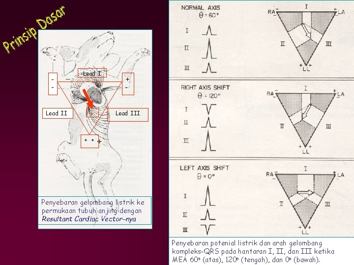 - Lead II Lead I + + - Lead III + + Penyebaran gelombang