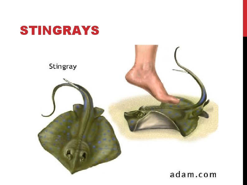 STINGRAYS STINGRAYS