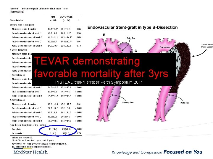 TEVAR demonstrating favorable mortality after 3 yrs INSTEAD trial-Nienaber Veith Symposium 2011 
