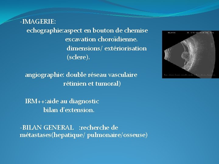  -IMAGERIE: echographie: aspect en bouton de chemise excavation choroïdienne. dimensions/ extériorisation (sclere). angiographie: