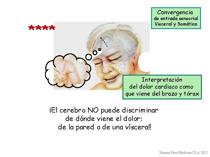 Convergencia **** de entrada sensorial Visceral y Somática Interpretación del dolor cardiaco como que