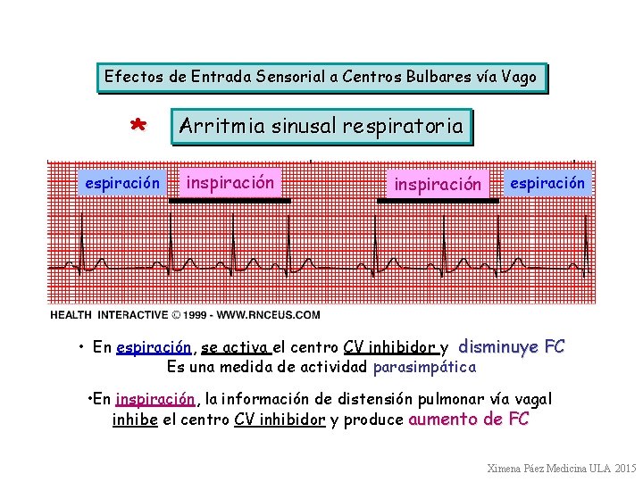 Efectos de Entrada Sensorial a Centros Bulbares vía Vago * espiración Arritmia sinusal respiratoria