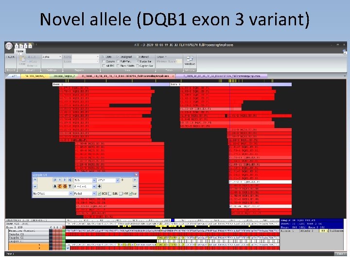 Novel allele (DQB 1 exon 3 variant) 