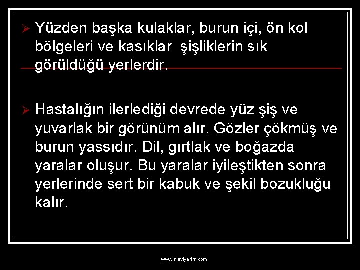 Ø Yüzden başka kulaklar, burun içi, ön kol bölgeleri ve kasıklar şişliklerin sık görüldüğü