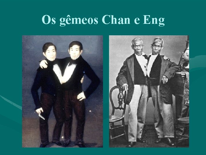 Os gêmeos Chan e Eng 