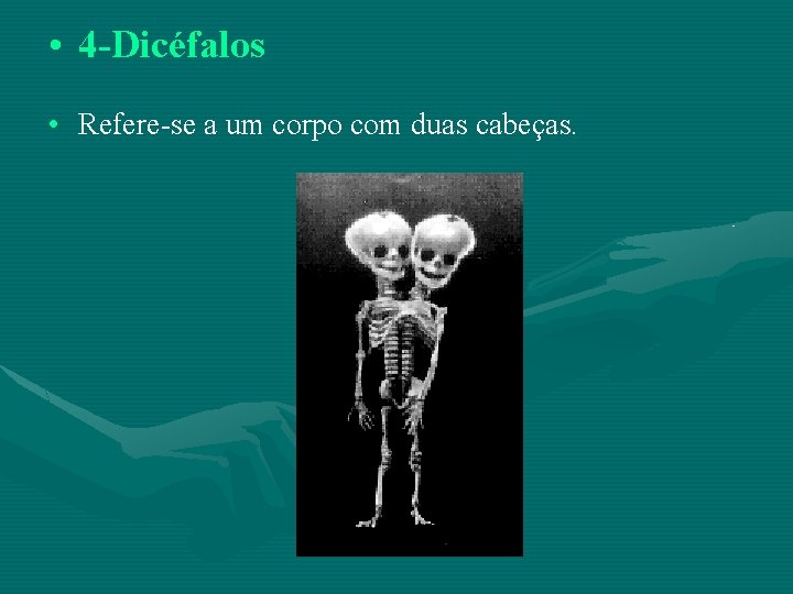 • 4 -Dicéfalos • Refere-se a um corpo com duas cabeças. 