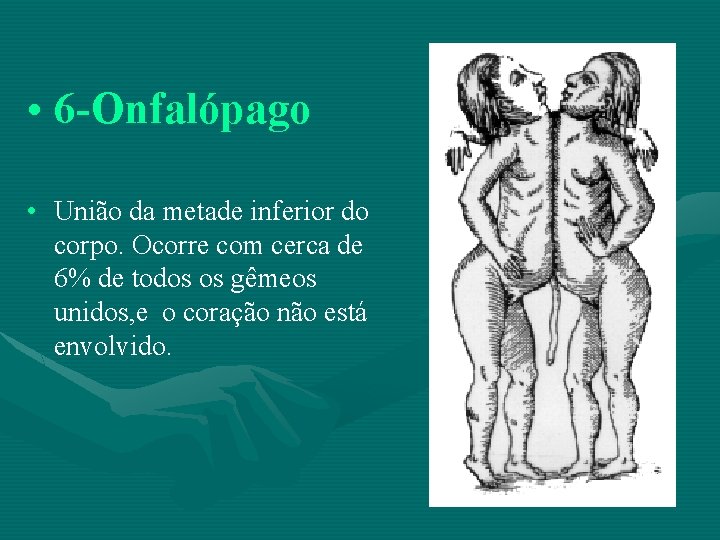  • 6 -Onfalópago • União da metade inferior do corpo. Ocorre com cerca