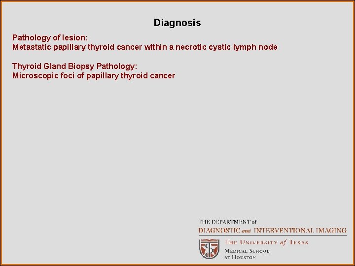 Diagnosis Pathology of lesion: Metastatic papillary thyroid cancer within a necrotic cystic lymph node