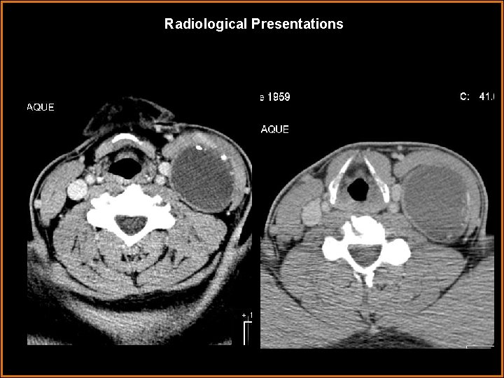 Radiological Presentations 