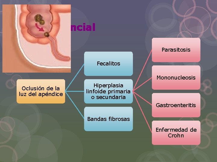 Evento incial Parasitosis Fecalitos Mononucleosis Oclusión de la luz del apéndice Hiperplasia linfoide primaria