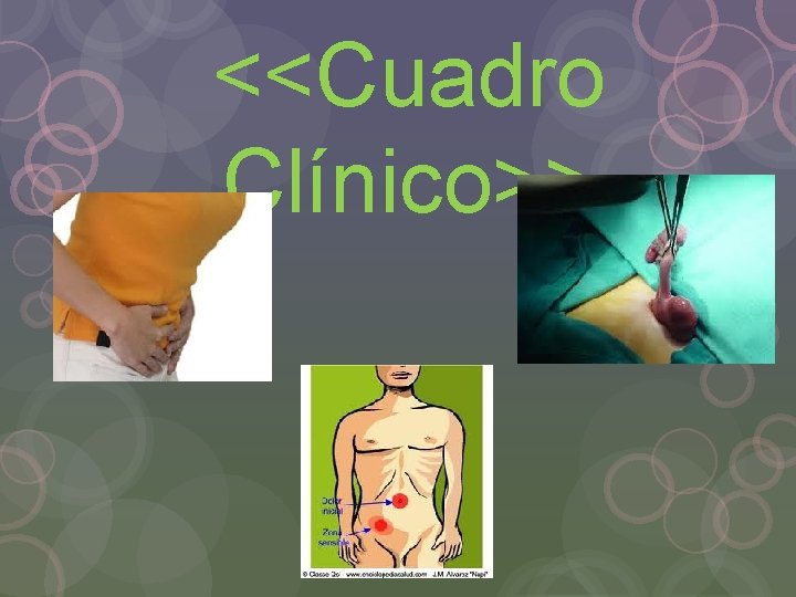 <<Cuadro Clínico>> 