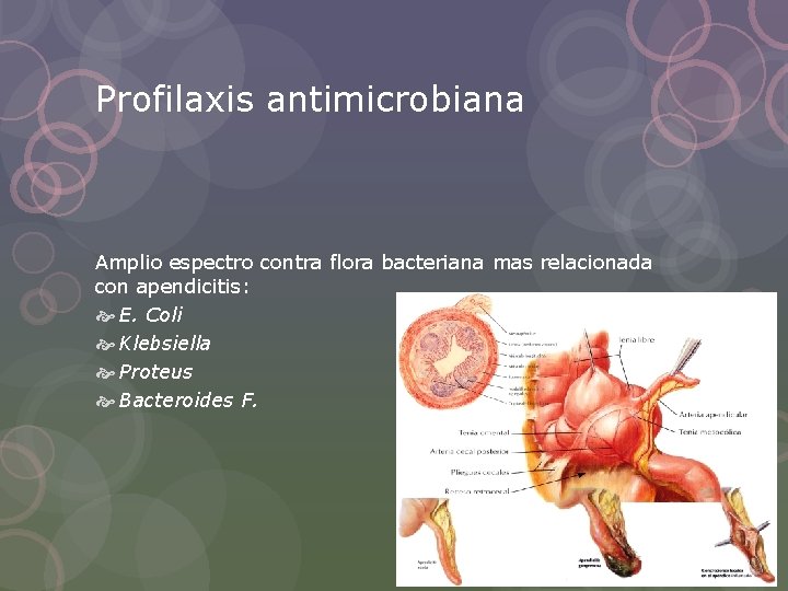 Profilaxis antimicrobiana Amplio espectro contra flora bacteriana mas relacionada con apendicitis: E. Coli Klebsiella