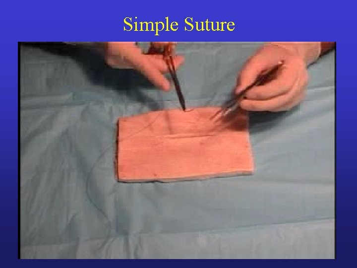 Simple Suture Simple Suture