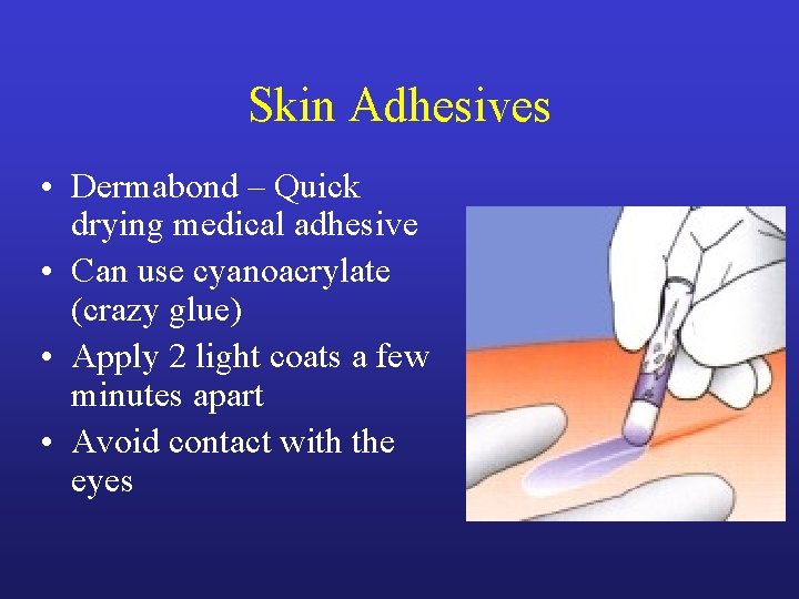 Skin Adhesives • Dermabond – Quick drying medical adhesive • Can use cyanoacrylate (crazy Skin Adhesives • Dermabond – Quick drying medical adhesive • Can use cyanoacrylate (crazy