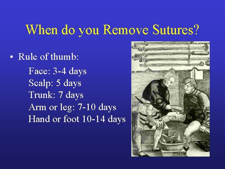 When do you Remove Sutures? • Rule of thumb: Face: 3 -4 days Scalp: When do you Remove Sutures? • Rule of thumb: Face: 3 -4 days Scalp: