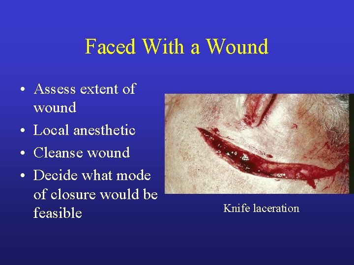Faced With a Wound • Assess extent of wound • Local anesthetic • Cleanse Faced With a Wound • Assess extent of wound • Local anesthetic • Cleanse
