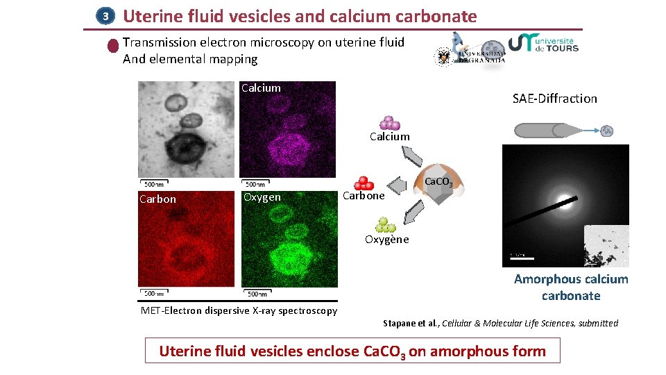 3 Uterine fluid vesicles and calcium carbonate Transmission electron microscopy on uterine fluid And 3 Uterine fluid vesicles and calcium carbonate Transmission electron microscopy on uterine fluid And