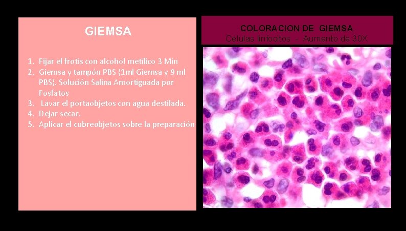 GIEMSA 1. Fijar el frotis con alcohol metílico 3 Min 2. Giemsa y tampón