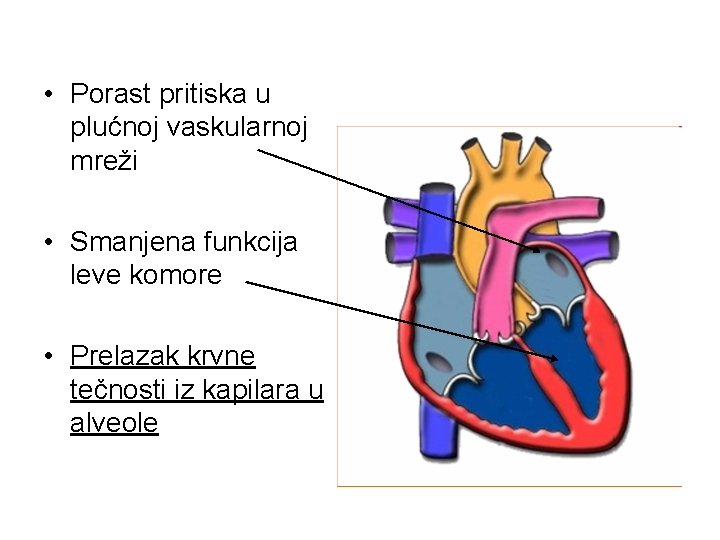  • Porast pritiska u plućnoj vaskularnoj mreži • Smanjena funkcija leve komore •