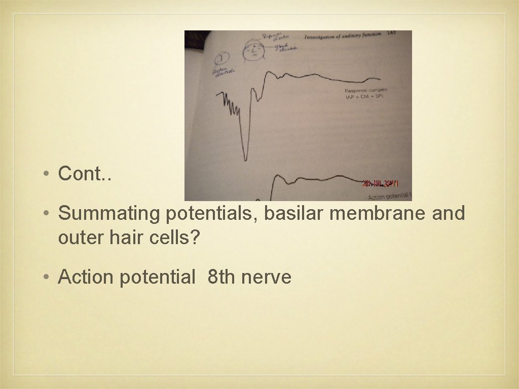  • Cont. . • Summating potentials, basilar membrane and outer hair cells? •