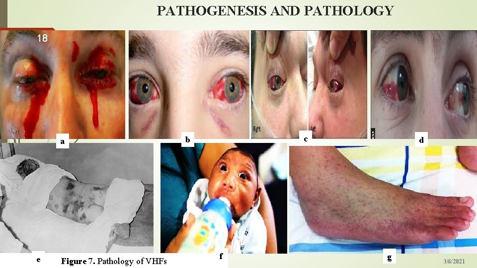 PATHOGENESIS AND PATHOLOGY 18 c b a d 1 e Figure 7. Pathology of