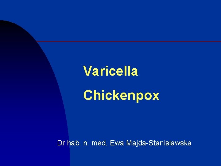 Varicella Chickenpox Dr hab. n. med. Ewa Majda-Stanislawska 