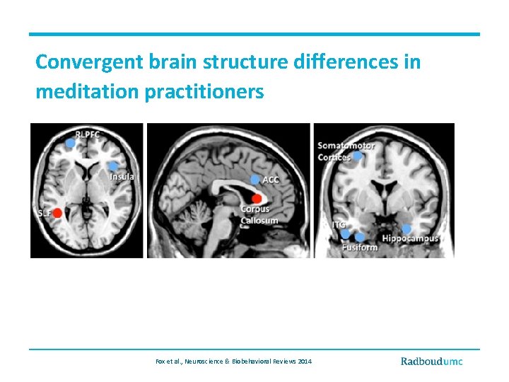 Convergent brain structure differences in meditation practitioners Fox et al. , Neuroscience & Biobehavioral