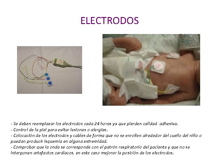 ELECTRODOS - Se deben reemplazar los electrodos cada 24 horas ya que pierden calidad