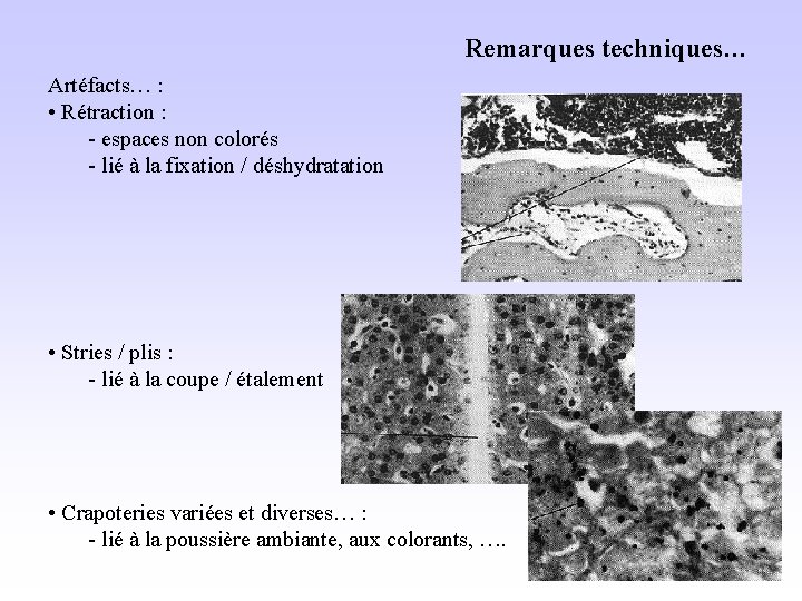 Remarques techniques… Artéfacts… : • Rétraction : - espaces non colorés - lié à