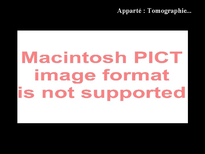 Apparté : Tomographie. . . 