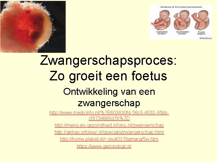 Zwangerschapsproces: Zo groeit een foetus Ontwikkeling van een zwangerschap http: //www. medicinfo. nl/%7 B