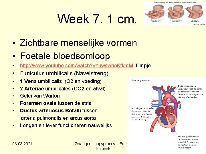 Week 7. 1 cm. • Zichtbare menselijke vormen • Foetale bloedsomloop • http: //www.