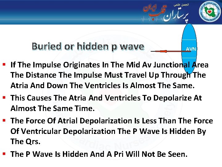 Buried or hidden p wave AVN § If The Impulse Originates In The Mid