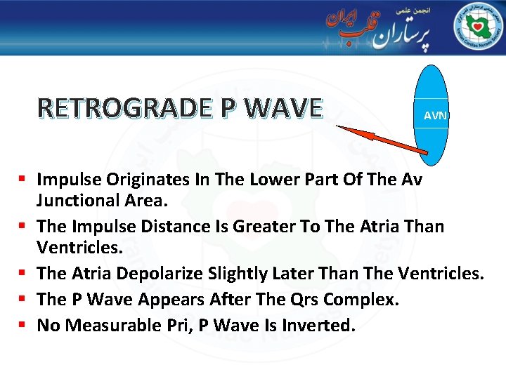 RETROGRADE P WAVE AVN § Impulse Originates In The Lower Part Of The Av