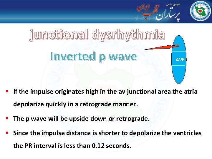 junctional dysrhythmia Inverted p wave AVN § If the impulse originates high in the