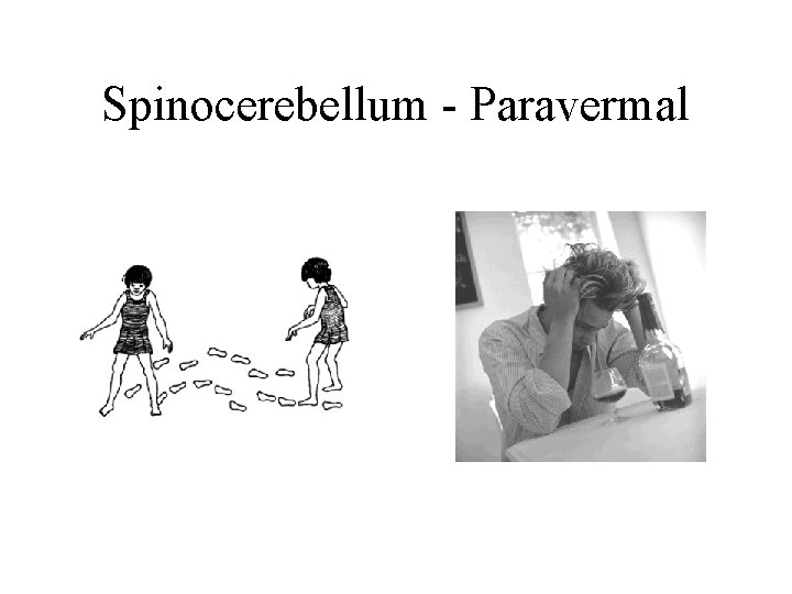 Spinocerebellum - Paravermal Spinocerebellum - Paravermal