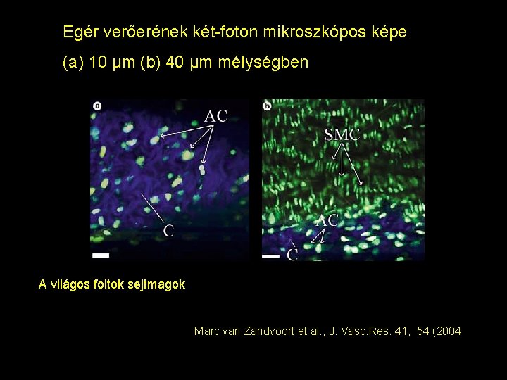 Egér verőerének két-foton mikroszkópos képe (a) 10 μm (b) 40 μm mélységben A világos