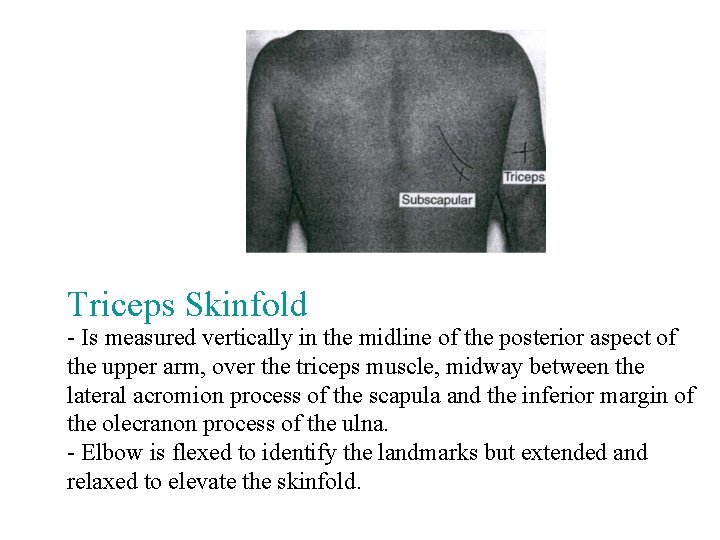 Triceps Skinfold - Is measured vertically in the midline of the posterior aspect of Triceps Skinfold - Is measured vertically in the midline of the posterior aspect of