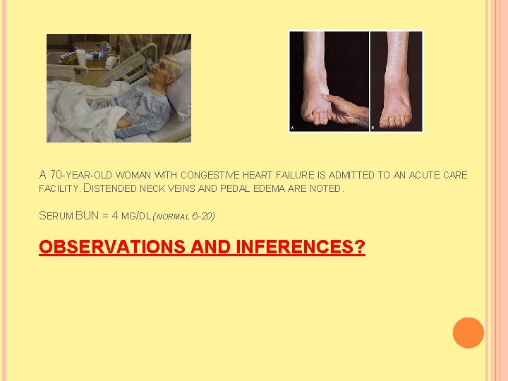 A 70 -YEAR-OLD WOMAN WITH CONGESTIVE HEART FAILURE IS ADMITTED TO AN ACUTE CARE A 70 -YEAR-OLD WOMAN WITH CONGESTIVE HEART FAILURE IS ADMITTED TO AN ACUTE CARE