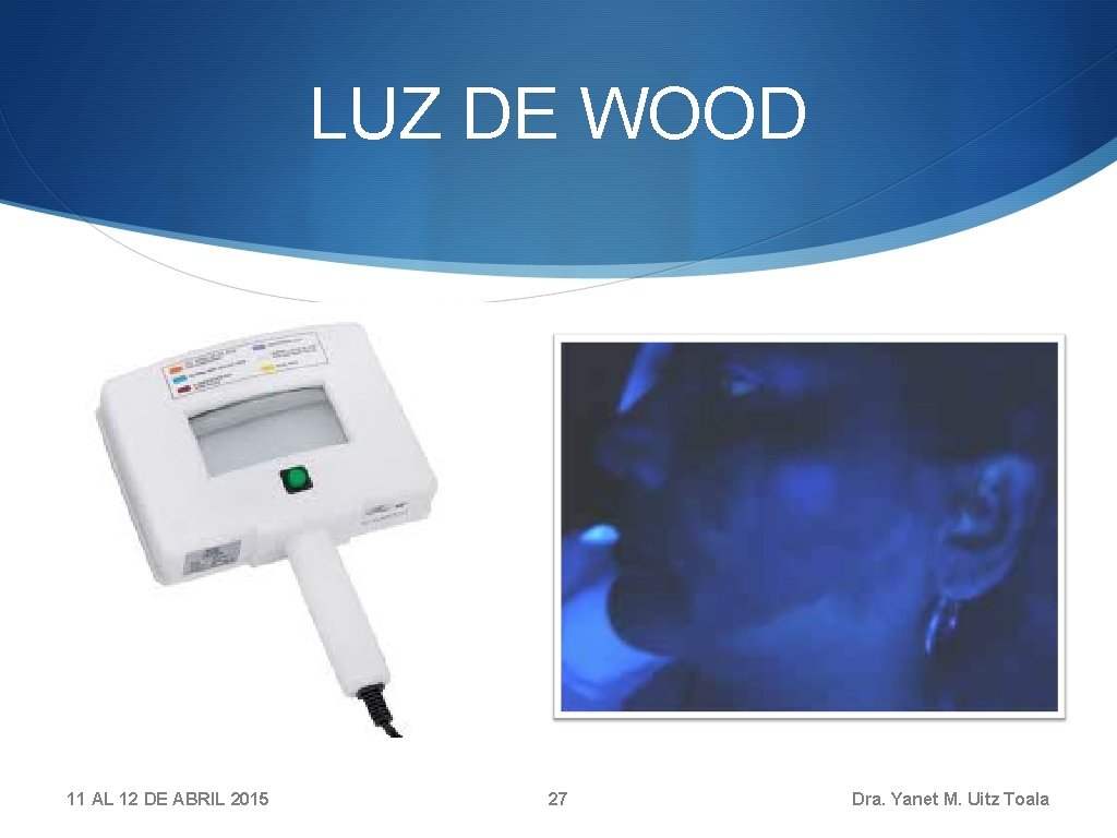 LUZ DE WOOD 11 AL 12 DE ABRIL 2015 27 Dra. Yanet M. Uitz