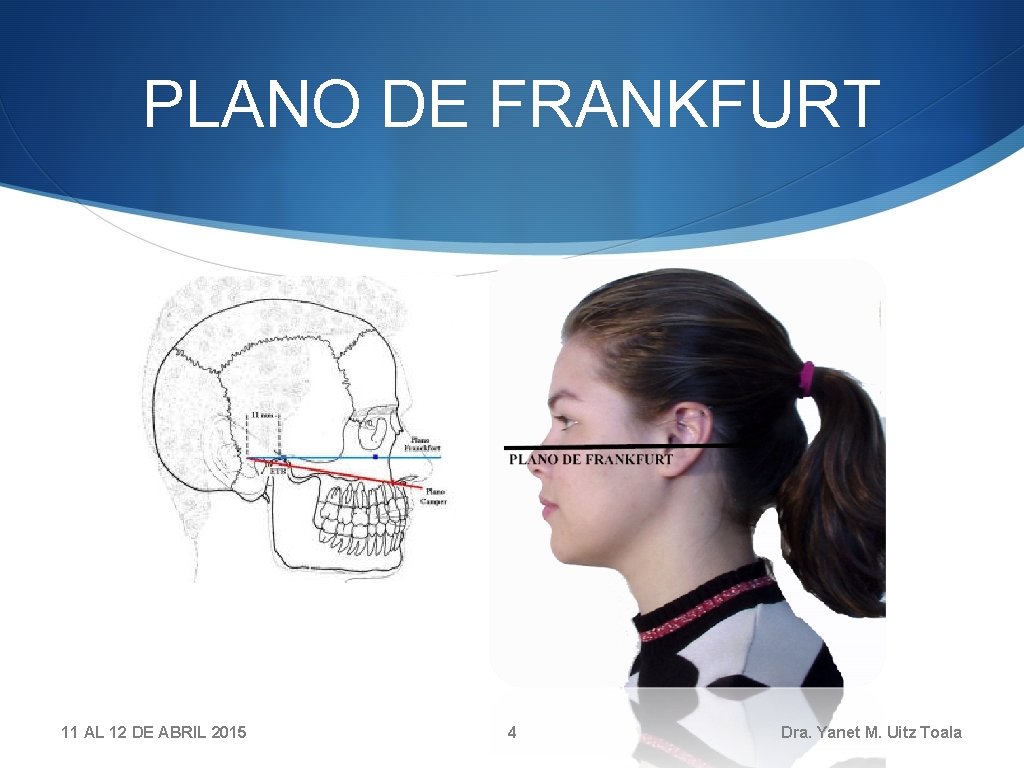 PLANO DE FRANKFURT 11 AL 12 DE ABRIL 2015 4 Dra. Yanet M. Uitz